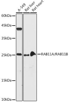 RAB11A/RAB11B antibody