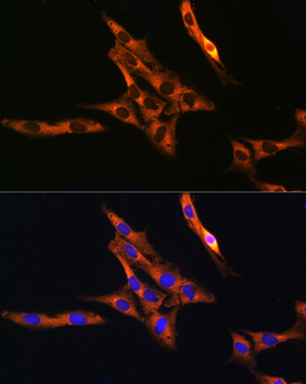 RAB11A/RAB11B antibody