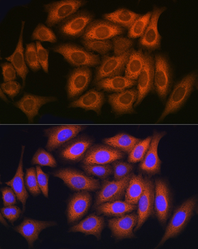 RAB11A/RAB11B antibody