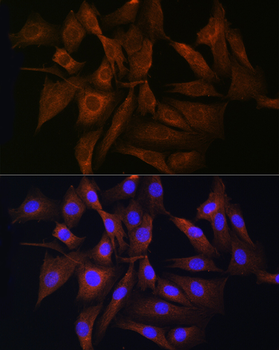 RAB11A/RAB11B antibody