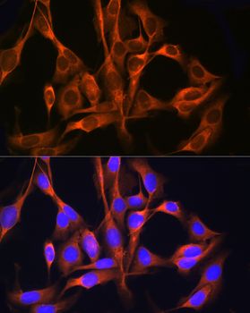 RAB11A/RAB11B antibody