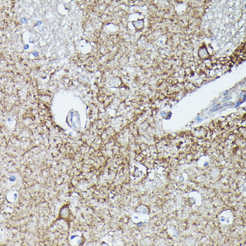 RAB11A/RAB11B antibody