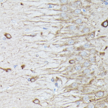 RAB11A/RAB11B antibody