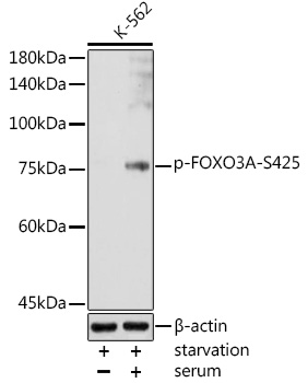 FOXO3A (Phospho-S425) antibody