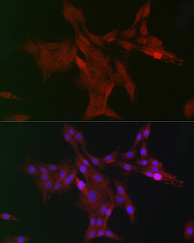 DCAF7 antibody