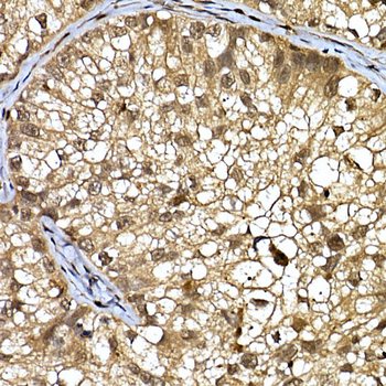 DCAF7 antibody