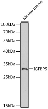 IGFBP5 antibody