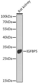 IGFBP5 antibody