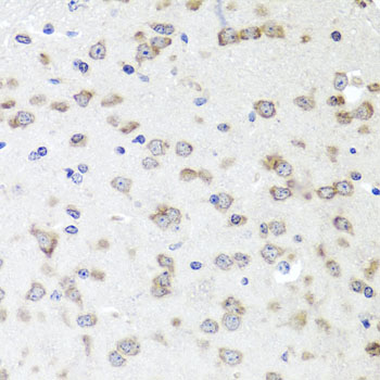 IGFBP5 antibody