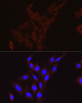 IGFBP5 antibody