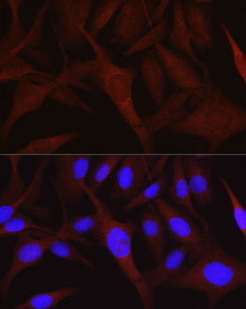 IGFBP5 antibody