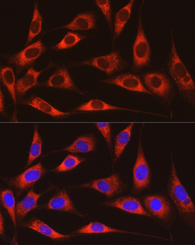 ARMET/ARP/MANF antibody