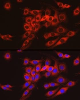 ARMET/ARP/MANF antibody