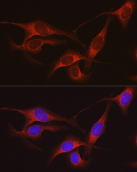 ARMET/ARP/MANF antibody