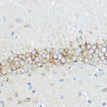 ABI1 antibody