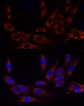 GLUD2 antibody