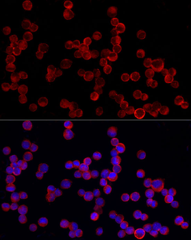 PDE4A antibody