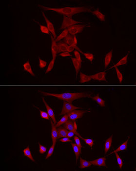 PDE4A antibody