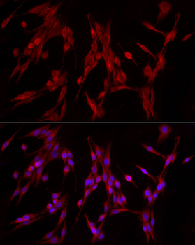 PDE4A antibody