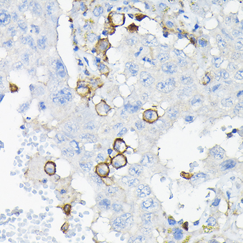 LILRB4 antibody