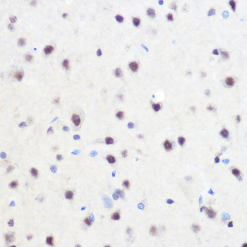 ZNF207 antibody