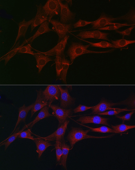 CSK antibody