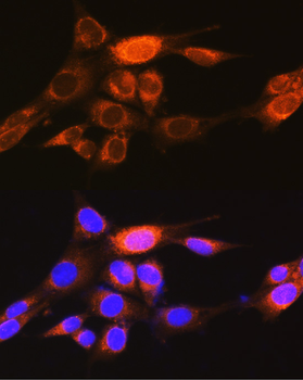 PKM1-specific antibody