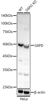 G6PD antibody