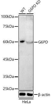 G6PD antibody