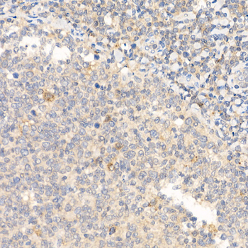 IL21 antibody