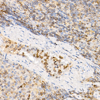 IL21 antibody