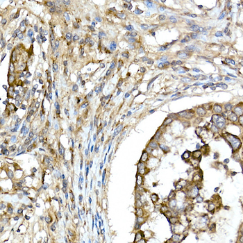 TNFAIP3 antibody