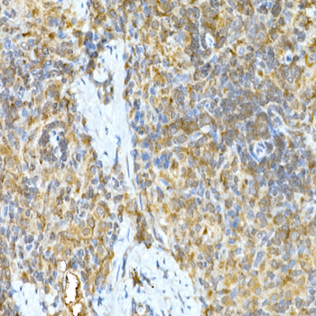 TNFAIP3 antibody