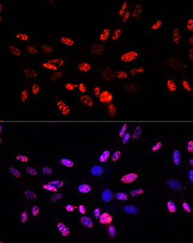 Histone H3 (Phospho-T45) antibody