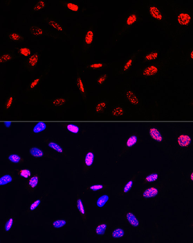 Histone H3 (Phospho-T45) antibody