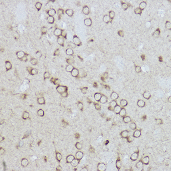 BiP/GRP78 antibody