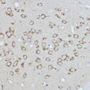 BiP/GRP78 antibody