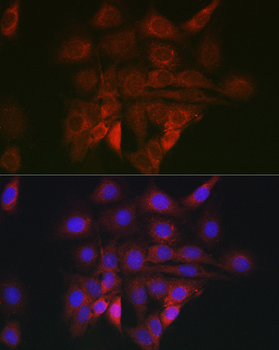 BiP/GRP78 antibody