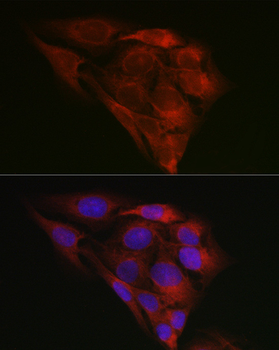 BiP/GRP78 antibody