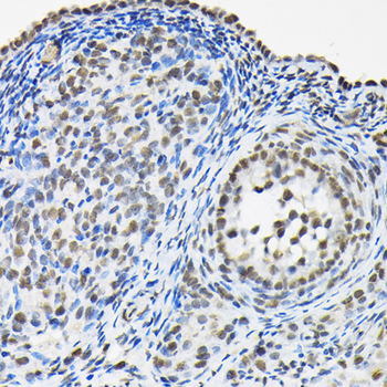 HNRNPA3 antibody