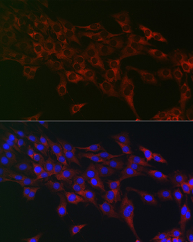 eIF4A1 antibody