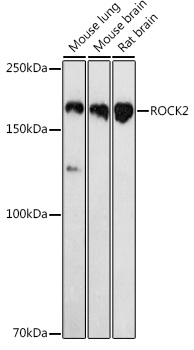 ROCK2 antibody