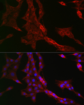 RMDN3 antibody