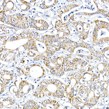 RMDN3 antibody