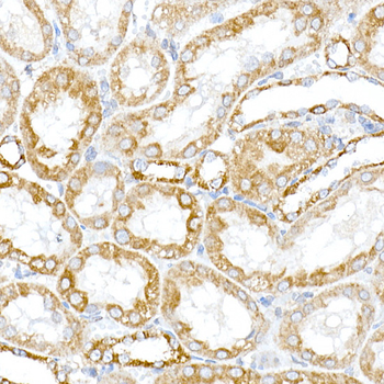 RMDN3 antibody