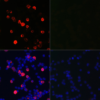 SARS-CoV-2 Nucleoprotein antibody