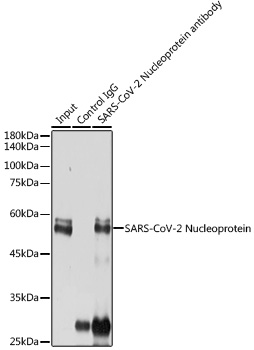 SARS-CoV-2 Nucleoprotein antibody