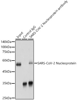 SARS-CoV-2 Nucleoprotein antibody