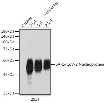 SARS-CoV-2 Nucleoprotein antibody