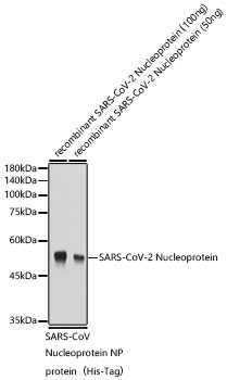 SARS-CoV-2 Nucleoprotein antibody